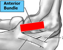 Ligament Exposure 2