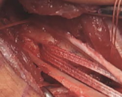 Surgical Options 2